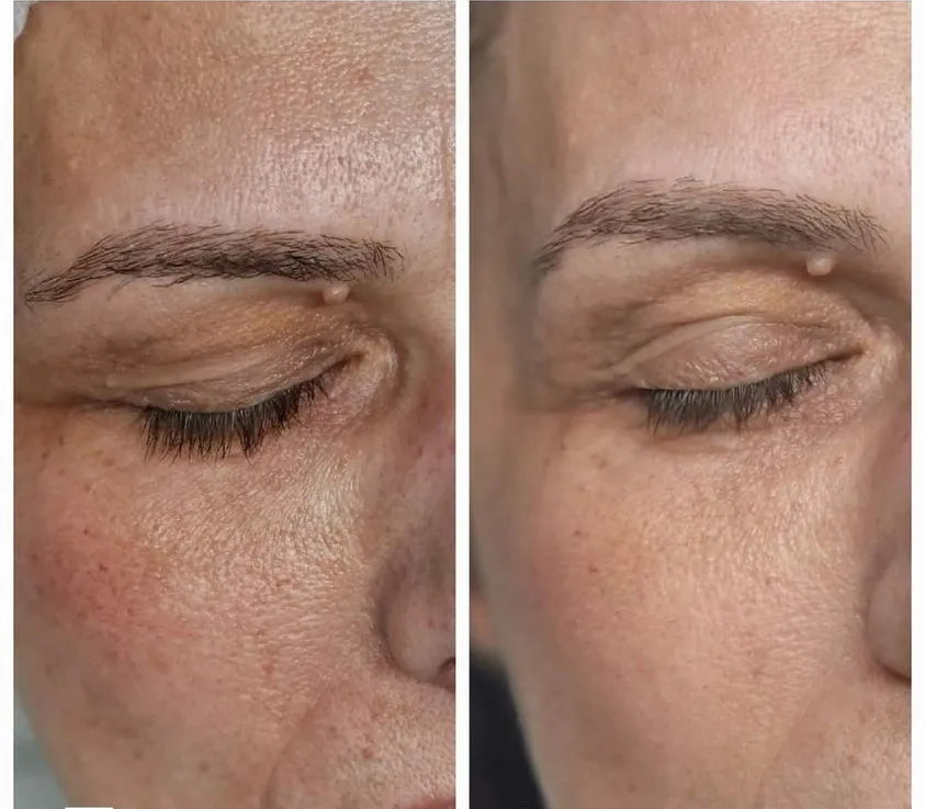 CHOLLEY Phyto-Exfoliant Mask