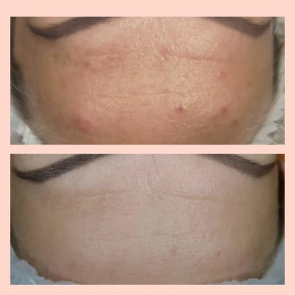 CHOLLEY Phyto-Exfoliant Mask